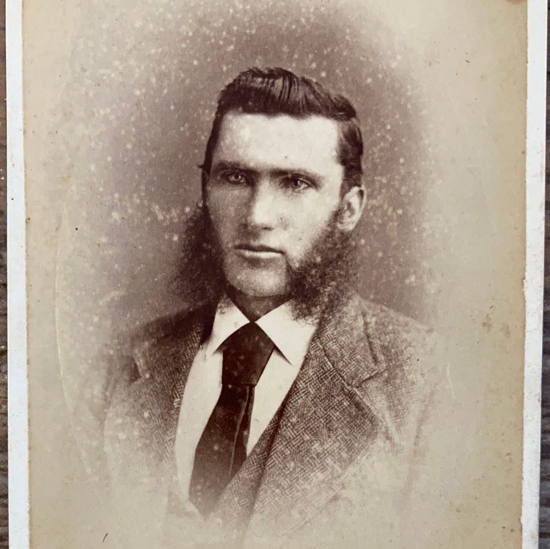 Original Antique Photograph Calling Card of a Young Man with Side Burns CDV